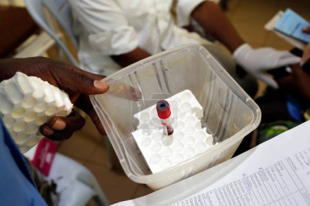 Téléchargez les photos : Biologie dans un hôpital africain. Un technicien de laboratoire analyse des échantillons de sang Bénin. - en image libre de droit