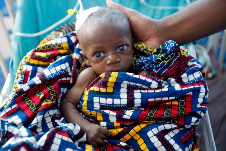 Téléchargez les photos : Hôpital africain. Service pédiatrique. Enfant en unité de soins intensifs. Bénin. - en image libre de droit