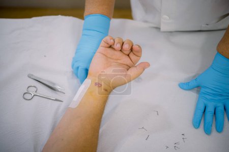 Photo for From above unrecognizable patient with wounded wrist holding hand over table near tools and doctor after stitches removal in hospital - Royalty Free Image