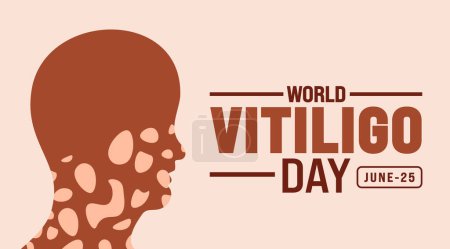 25 june is World vitiligo day background template. Holiday concept. use to background, banner, placard, card, and poster design template with text inscription and standard color. vector illustration.
