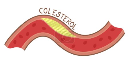 Creative design of cholesterol illustration, cholesterol word in spanish