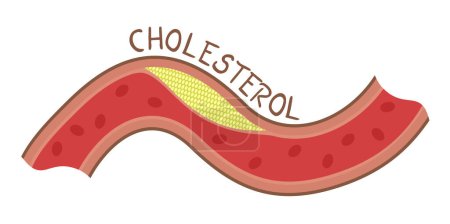 Ilustración de Diseño creativo de la ilustración del colesterol - Imagen libre de derechos