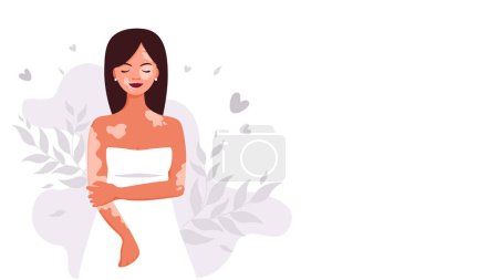 A woman with vitiligo skin disease accepts her appearance, loves herself. World Vitiligo Day. Body positive concept. Vector illustration for banner, poster or landing page