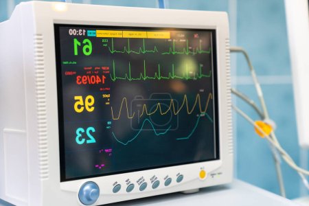 Foto de Máquina moderna de ekg en la sala de emergencias del hospital utilizada para el diagnóstico de ataque cardíaco - Imagen libre de derechos