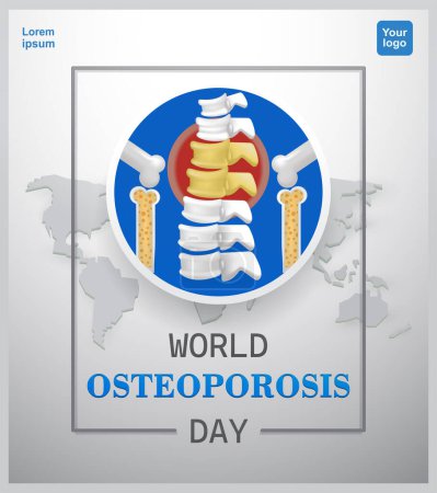 Ilustración de Día Mundial de la Osteoporosis. Problemas con la columna vertebral y las articulaciones en el fondo del mapa del mundo. 3d vector, adecuado para la salud, carteles, pancartas, educación y eventos - Imagen libre de derechos