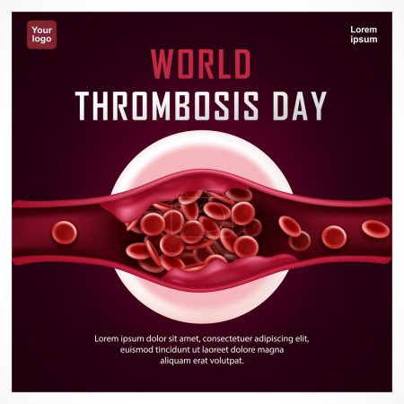 World Thrombosis Day. Blockage of blood vessels. 3d vector, suitable for health, design elements and events