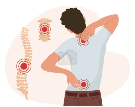 Ilustración de Un hombre con dolor en las vértebras cervical y lumbar. Dolor de espalda, dolor muscular, osteoartritis, artritis reumatoide. Medicina. Ilustración, vector - Imagen libre de derechos