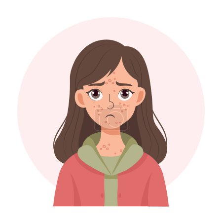 Acne. Unhappy teenage girl with acne and pimples on her face. Irritated facial skin. Illustration, vector