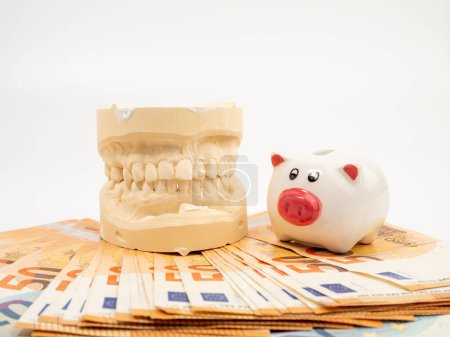 Photo for Dental casts, piggy bank and banknotes on a white background. Plaster model of teeth. Close-up. - Royalty Free Image