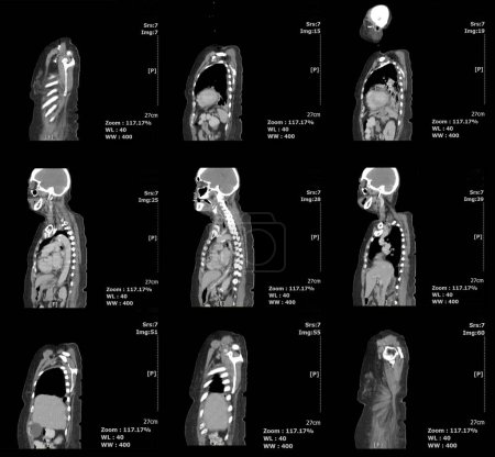 Téléchargez les photos : Ct scanner l'abdomen, la poitrine et à côté du corps par IRM. radiologie médicale. - en image libre de droit
