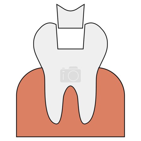 Illustration for Icon filling tooth crown restoration infographic dental filling doctor dentist - Royalty Free Image