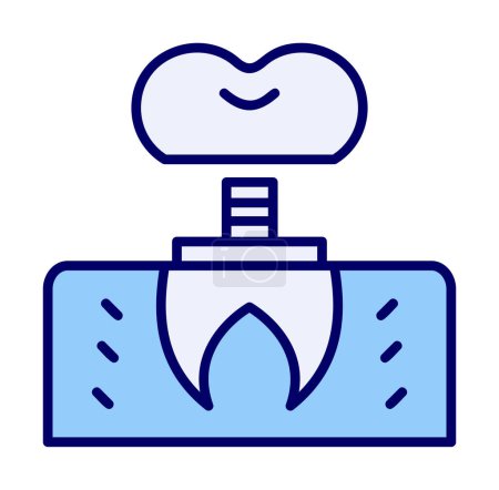 Ilustración de Odontología icono de implante contorno vector. - Imagen libre de derechos