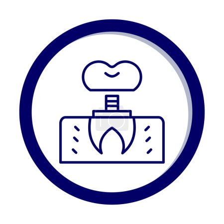 Téléchargez les illustrations : Image vectorielle de contour de l'icône de l'implant dentaire. - en licence libre de droit