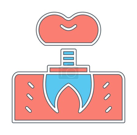 Dentistry implant icon outline vector. 