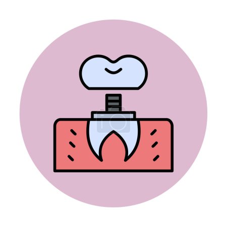 Illustration for Dentistry implant icon outline vector. Dental tooth. - Royalty Free Image