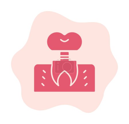 Dentistry implant icon outline vector. Dental tooth. 
