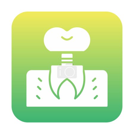 Dentistry implant icon outline vector. Dental tooth. 