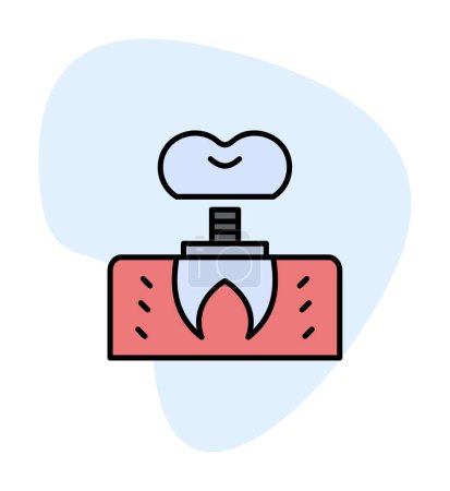 Ilustración de Odontología icono de implante contorno vector. Diente dental. - Imagen libre de derechos