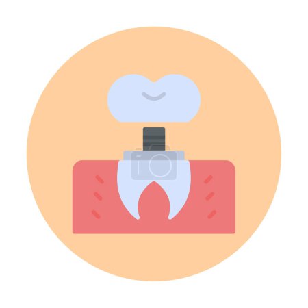 Illustration for Dentistry implant icon outline vector. Dental tooth. - Royalty Free Image