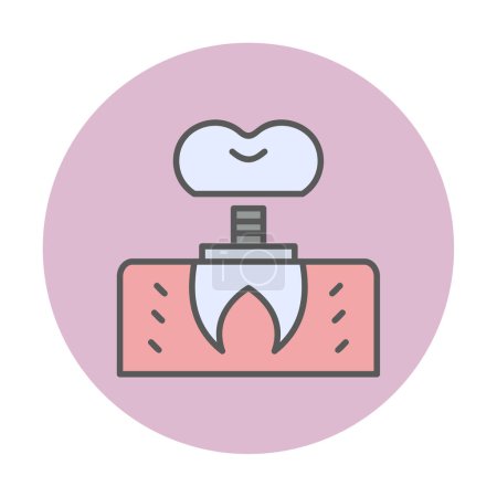 Téléchargez les illustrations : Dentistry implant icon outline vector. Dental tooth. - en licence libre de droit