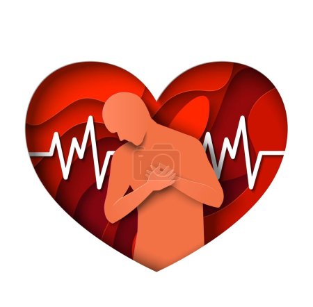 Mann hält Brust über Herzinfarkt-Symbolvektor. Patientin leidet an Brustschmerzen Illustration. Herzprobleme, Koronarerkrankungen. Origami-Ikone aus Papier