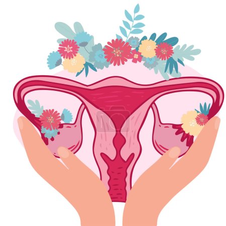 Illustration for Women health - Floral of Polycystic ovary syndrome. Patient-friendly scheme of PCOS, Multifollicular cyst. Gynecological problems - Neutral medical diagram uterus and uterine appendages hand drawing. - Royalty Free Image