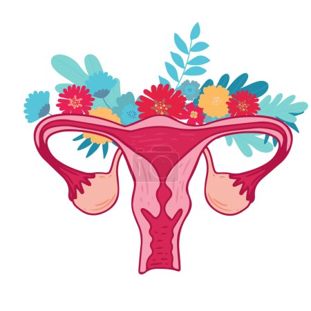 Illustration for Women health - Floral Infographic of Polycystic ovary syndrome. Patient-friendly scheme of PCOS, Multifollicular cyst. Gynecological problems - Neutral medical diagram uterus and uterine appendages - Royalty Free Image