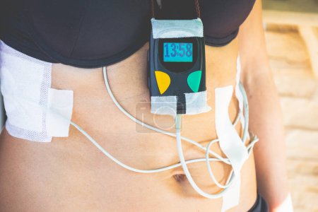Photo for Woman with a holter monitor ECG device helded shoulder strap with cables and patches indicates the time - Royalty Free Image