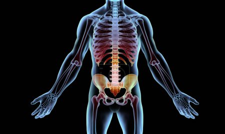 Photo for 3d rendered illustration of a human skeleton with pelvic pain - Royalty Free Image