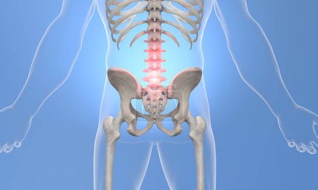 Photo for Lumbar pain skeletal view on blue x-ray - Royalty Free Image