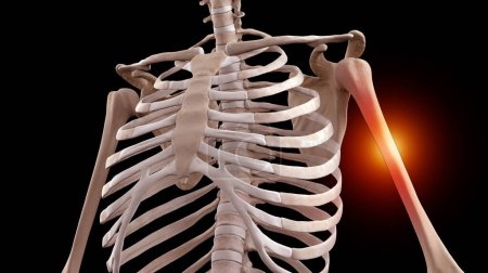 Photo for 3D medical illustration of human skeleton with broken humerus - Royalty Free Image
