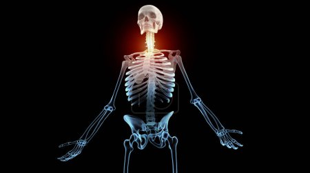 Photo for Human skeleton with pain in cervical region of the spine - Royalty Free Image