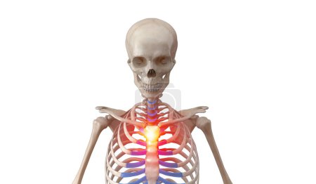 Photo for Human skeleton with chest pain highlights - Royalty Free Image