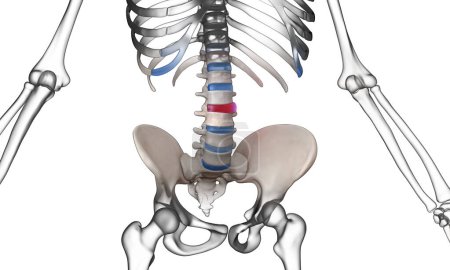 Bulging disc lumbar spinal injury on human skeleton medical illustration