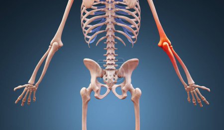 3d ilustración representada de una anatomía humana con dolor de codo