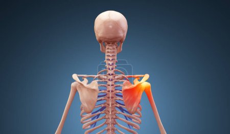 Human x-ray skeleton with shoulder joint injury