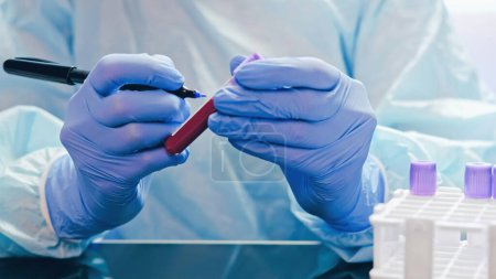 Photo for Blood research. Medical laboratory. Virus test. Technician hands in rubber protective gloves marking analysis samples in tubes at table with equipment. - Royalty Free Image