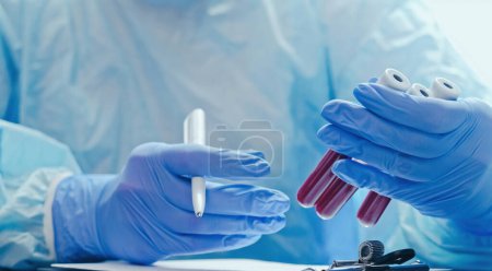 Photo for Blood test. Clinic laboratory. Nurse studying serum samples recording results with hands in medical protective rubber gloves with tubes and pen. - Royalty Free Image