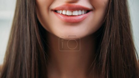 Téléchargez les photos : Soins dentaires. Réparation des dents. Esthétique orthodontique. Femme brune heureuse méconnaissable avec sourire tordu dans la publicité de prothèse de beauté de santé buccodentaire. - en image libre de droit
