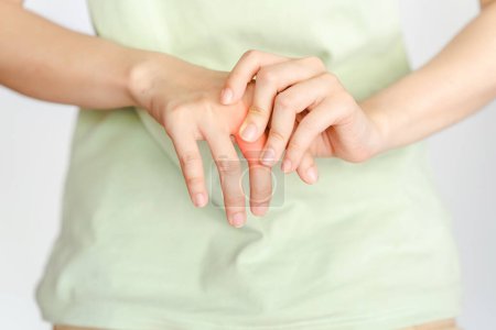 Foto de Una mujer toca su nudillo debido a una lesión o artritis reumatoide. - Imagen libre de derechos