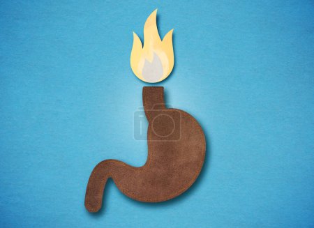 Photo for Heartburn or Pyrosis - GERD - Gastroesophageal Reflux Disease - Conceptual Illustration - Royalty Free Image