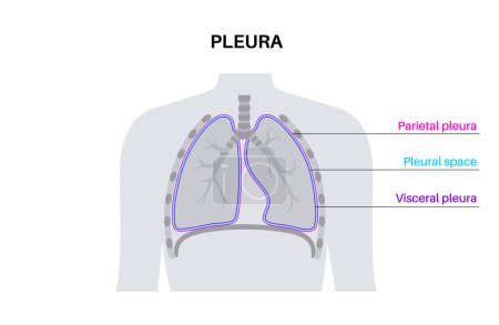 Illustration for Pleura anatomy concept. Chest cavity medical poster. Membrane tissue in human body. Respiration system scheme. Pulmonary pleurae diagram. Lungs, trachea, bronchi and ribs flat vector illustration. - Royalty Free Image