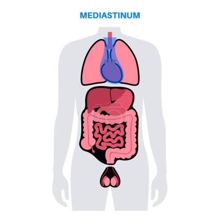 Téléchargez les illustrations : Affiche anatomique Mediastinum. Espace dans la poitrine qui contient le cœur, les poumons et d'autres structures, la cavité thoracique dans le corps humain. Illustration vectorielle plate médicale de cavité pleurale gauche et droite - en licence libre de droit