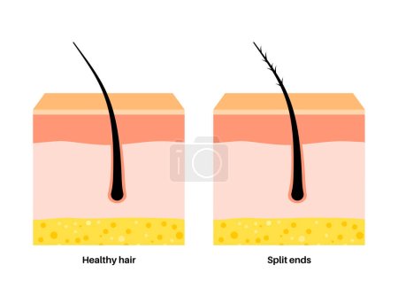 Split ends and hair breakage poster. Head disease and unhealthy hair concept. Effect of temperature on human hair. Skin layers diagram, epidermis, dermis and hypodermis, flat vector illustration.