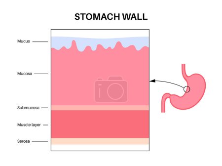 Illustration for Mucous membrane anatomical poster. Stomach wall structure. Soft tissue that lines the canals and organs in the digestive system. Mucosa, submucosa, muscle layer and serosa medical vector illustration. - Royalty Free Image