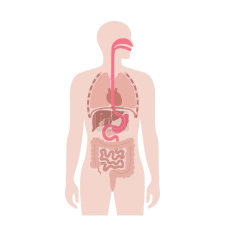Endoscopic sleeve gastroplasty. Stomach surgery, weight loss gastric procedure. Laparoscopy concept. Overweight problem in human body. Internal organ after operation. Flat vector medical illustration