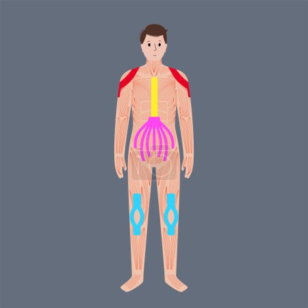 Illustration for Elastic therapeutic tape. Kinesiology tape on leg, shoulder and abdomen. KT method, elastic strip purported to ease pain from injuries. Protection for muscles and ligaments flat vector illustration - Royalty Free Image