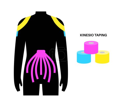 Illustration for Elastic therapeutic tape. Kinesiology tape on shoulder and abdomen. KT method, elastic strip purported to ease pain from athletic injuries. Protection for muscles and ligaments vector illustration. - Royalty Free Image