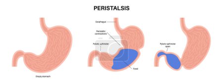 Ilustración de Cartel anatómico del movimiento del peristaltismo. Los músculos mueven el quimo a través del sistema digestivo. Concepto del tracto gastrointestinal. Comida en el cuerpo humano. Esófago estómago e intestinos vector plano ilustración - Imagen libre de derechos