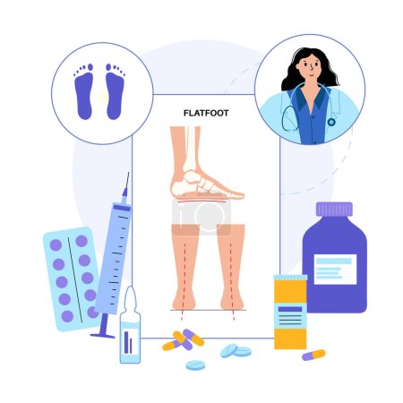 Illustration for Flat feet medical poster. Abnormal feet arch condition, supination. Body balance problem. Flatfoot concept. Ankle pathology diagnostic, treatment in podiatry clinic medical flat vector illustration - Royalty Free Image